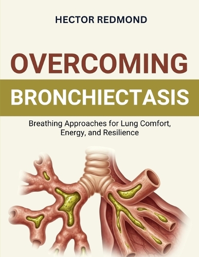 Overcoming Bronchiectasis