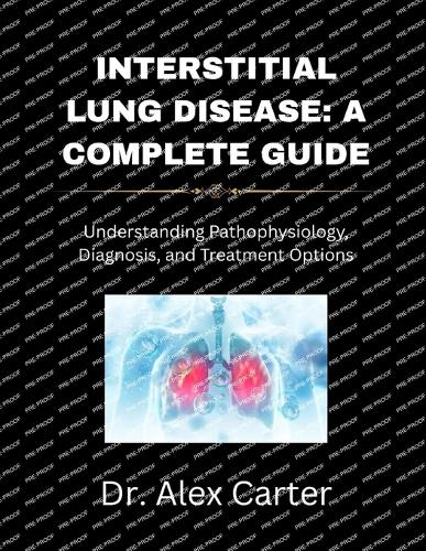 Interstitial Lung Disease