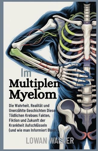 Im Multiplen Myelom