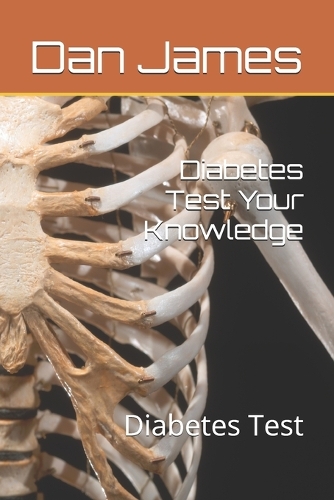 Diabetes Test Your Knowledge