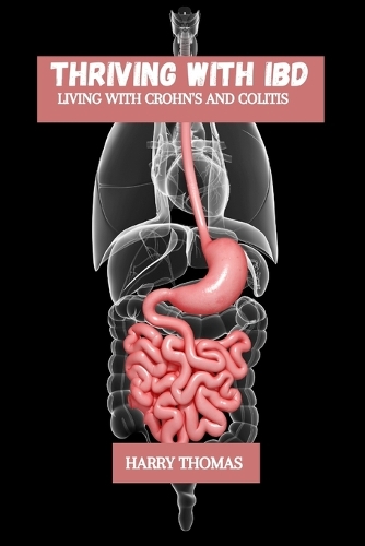 Thriving with IBD