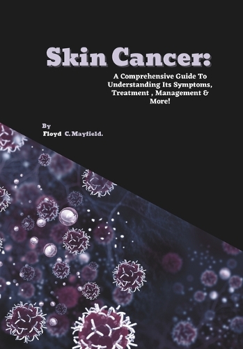 Skin Cancer