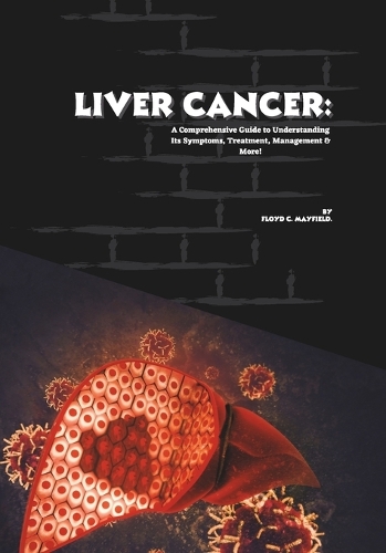 Liver Cancer