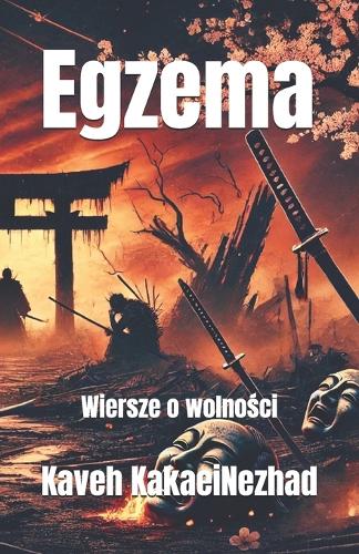 Egzema