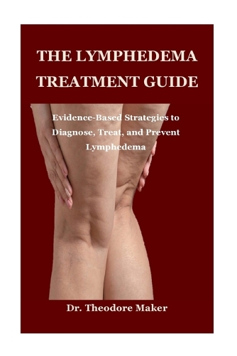 The Lymphedema Treatment Guide