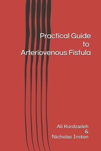 Practical Guide To Arteriovenous Fistula