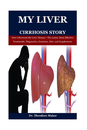 My Liver Cirrhosis Story