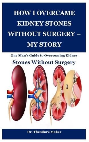 How I Overcame Kidney Stones Without Surgery - My Story