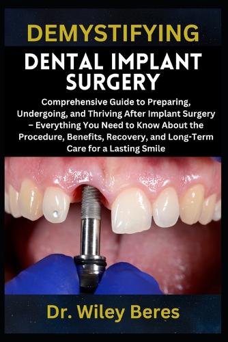 Demystifying Dental Implant Surgery