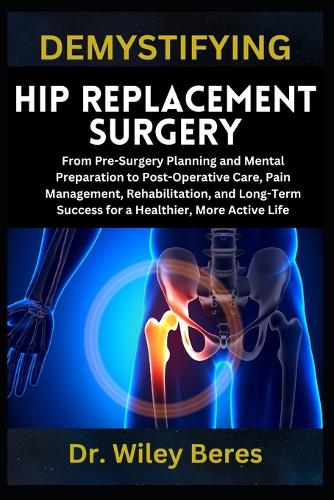 Demystifying Hip Replacement Surgery
