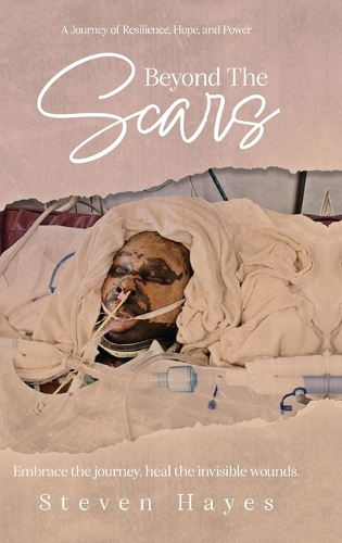 Beyond The Scars