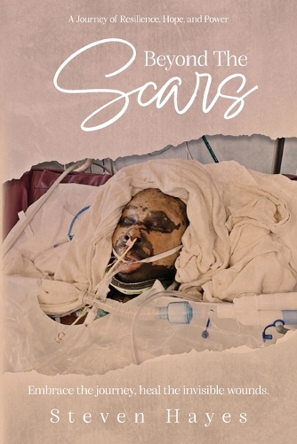 Beyond The Scars