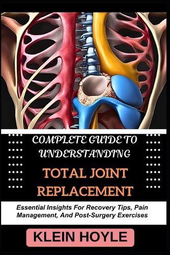 Complete Guide to Understanding Total Joint Replacement