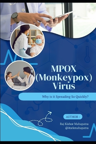 MPOX (Monkeypox) Virus