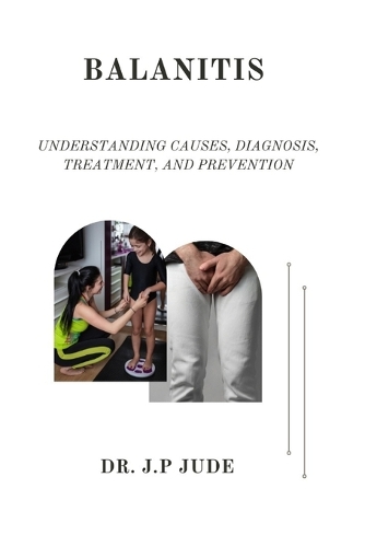 Balanitis