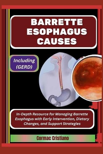 Barrette Esophagus Causes