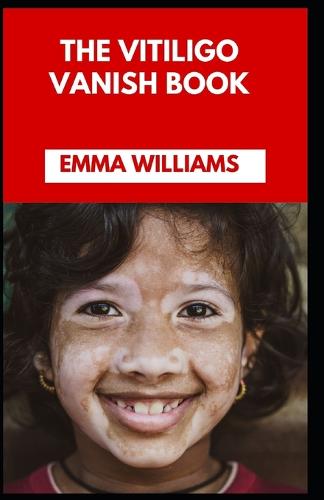 The Vitiligo Vanish Book