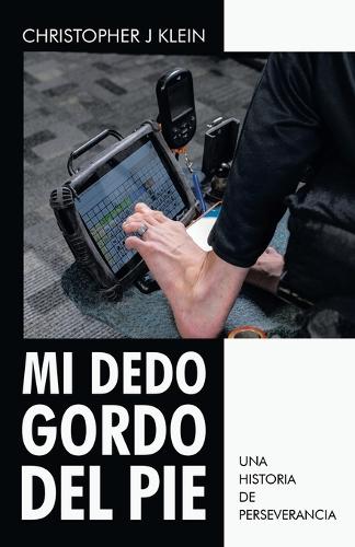 Mi dedo gordo del pie
