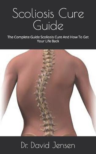 Scoliosis Cure Guide