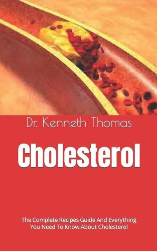 Cholesterol