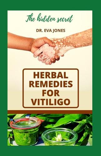Herbal RЕmЕdІЕЅ For Vitiligo