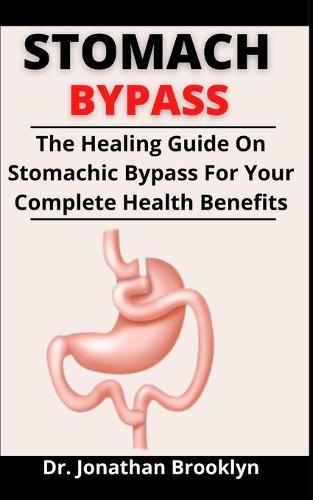 Stomachic Bypass