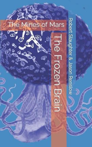 The Frozen Brain