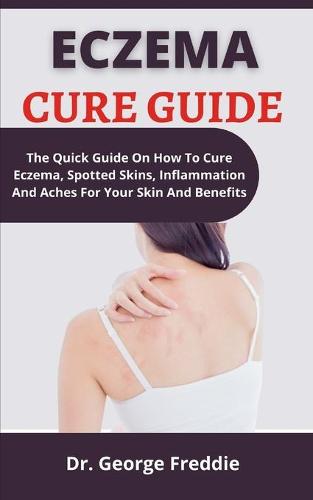 Eczema Cure Guide
