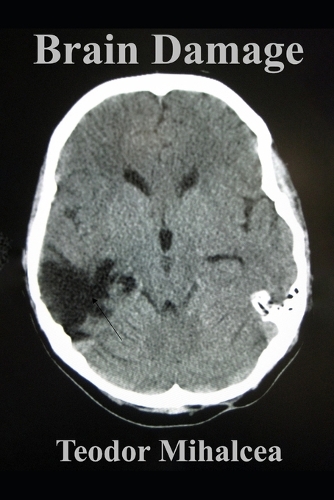 Brain Damage