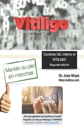 Controle Ud. mismo el Vitiligo