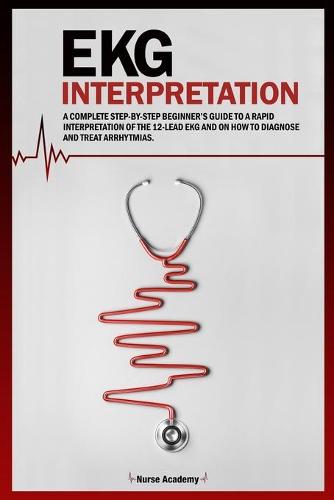 EKG Interpretation
