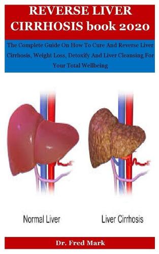 Reverse Liver Cirrhosis Book 2020