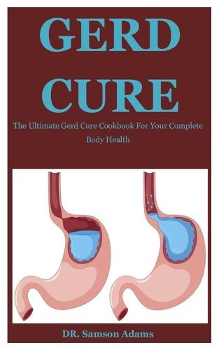 Gerd Cure