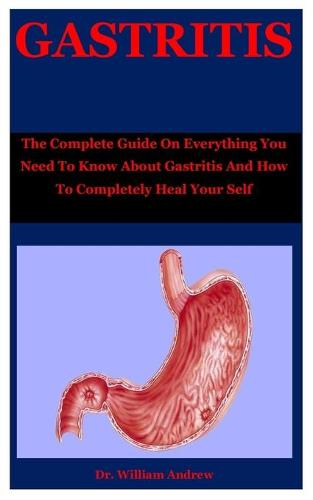 Gastritis
