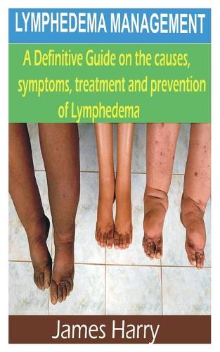Lymphedema Management