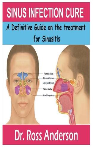 Sinus Infection Cure
