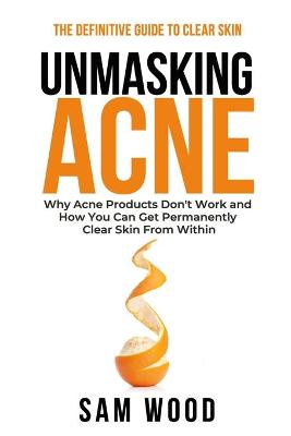 Unmasking Acne