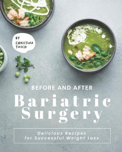 Before and After Bariatric Surgery