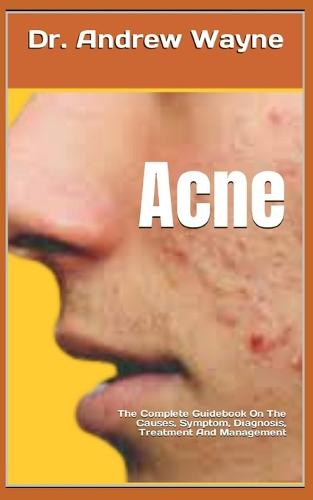 Acne