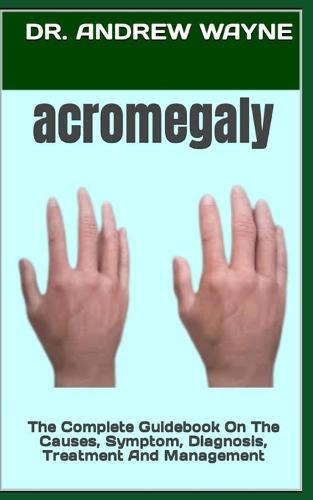 acromegaly