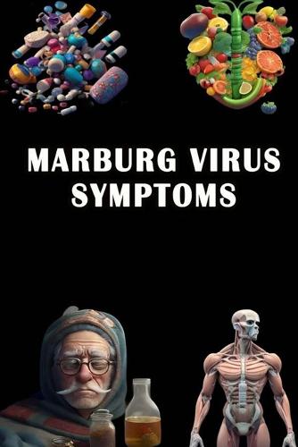 Marburg Virus Symptoms