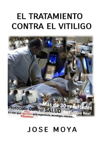 El tratamiento contra el Vitiligo