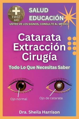Cirugía De Extracción De Cataratas