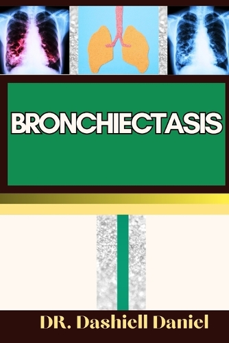 Bronchiectasis