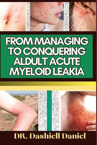 From Managing to Conquering Aldult Acute Myeloid Leakia
