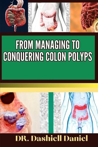From Managing to Conquering Colon Polyps
